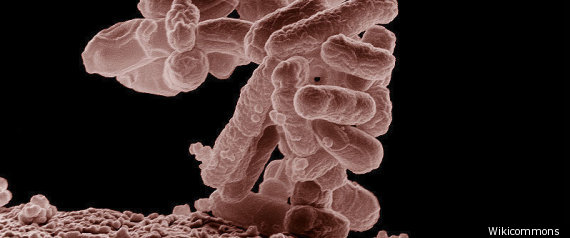 Superbuggene