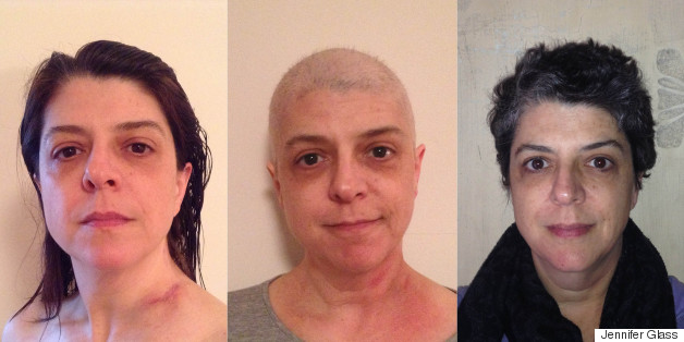 One Woman With Lung Cancer Photographed Herself Every Day For A Year