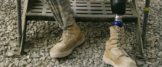 Afghanistan Amputation