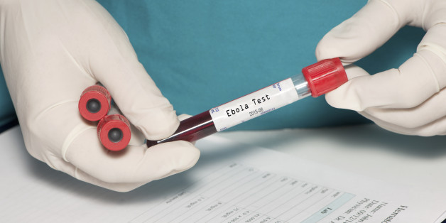 Rapid Ebola Test Approved For Emergency Use | HuffPost