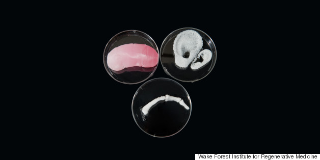 Could 3D-Printed Organs Save Lives?