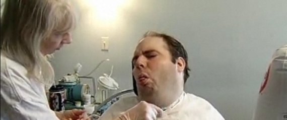 Quadriplegic Man