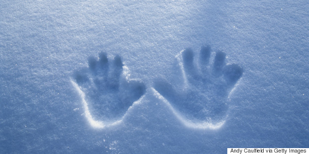 Syracuse Student May Lose Four Fingers After Allegedly Being Hazed In The Snow
