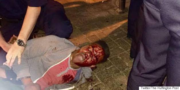 Black UVA Student Bloodied During Arrest By State Liquor Cops