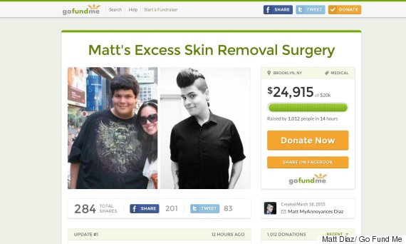 matt diaz before