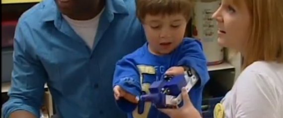 Michael Amerman Prosthetic Arm