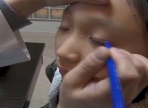 Asia Plastic Surgery