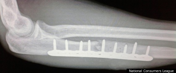 Xray