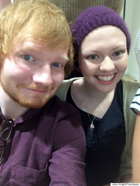 ed sheeran jess knight