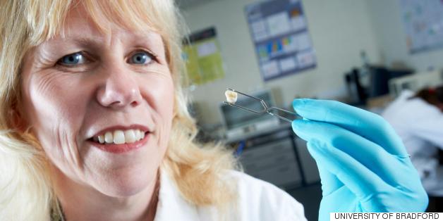 How Baby Teeth Can Predict Health Problems In Adulthood