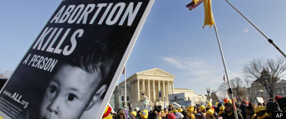Abortion