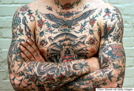 ... , expensive - tattoo removal surgery could well and truly be over