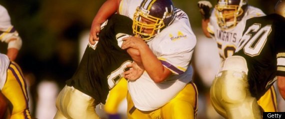 Concussion Risks