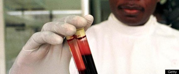 Hiv Target Drug