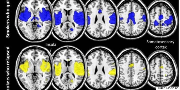 What Smokers' Brains Reveal About The Ability To Kick The Habit