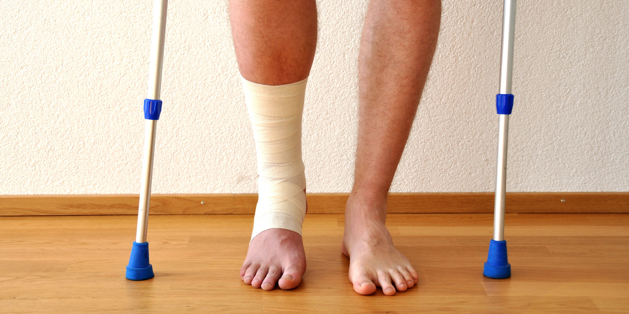 So You Broke A Bone . . . Now What? HuffPost