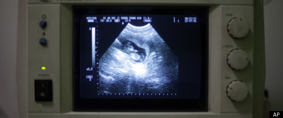 Sonogram