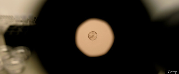 Germany Embryo Test