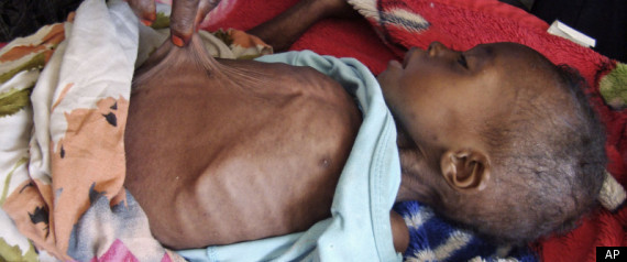 Famine