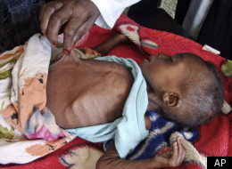 Famine In East Africa A Tragic Case Of Deja Vu