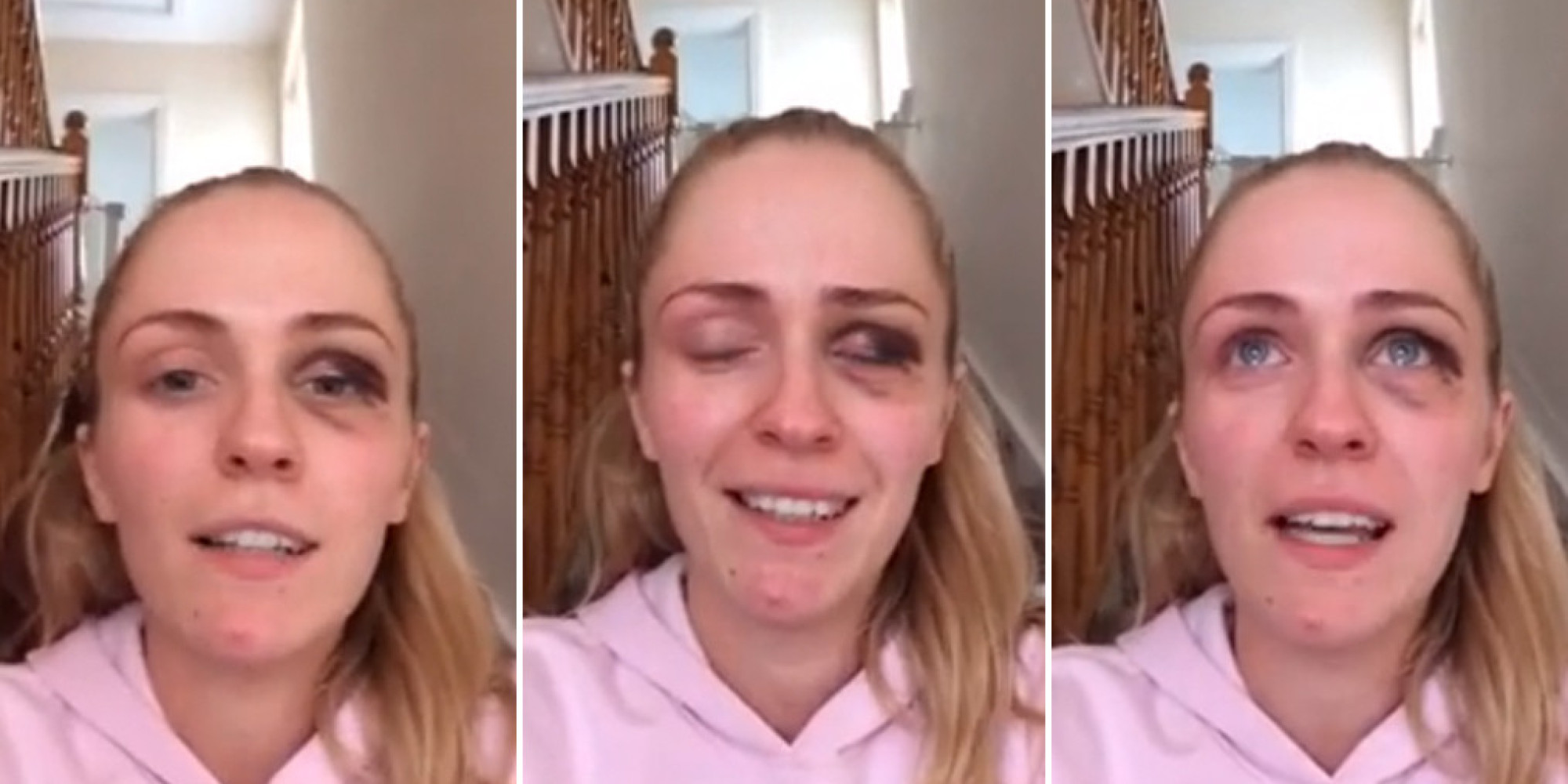 Domestic Violence Victim Shares Emotional Video To Facebook To Help