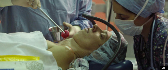 Hypnosis Surgery