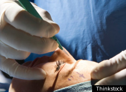 1 In 3 Nose Job Patients Has Body Dysmorphic Disorder: Study