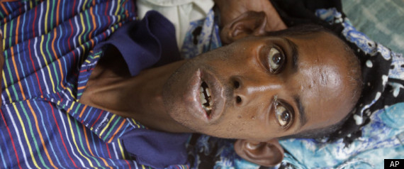 Somalia Drought