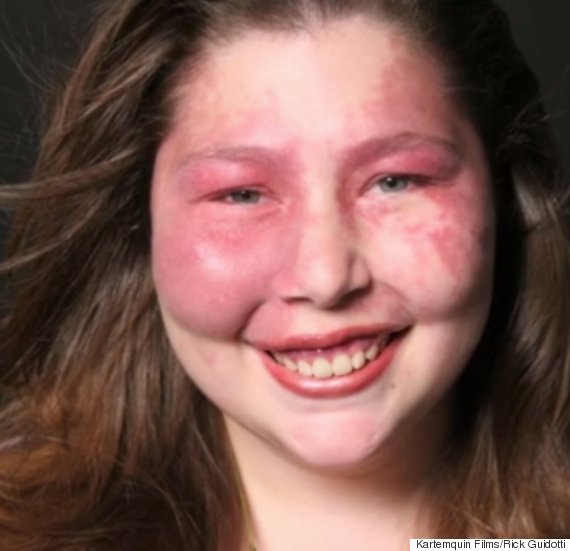 visible genetic condition