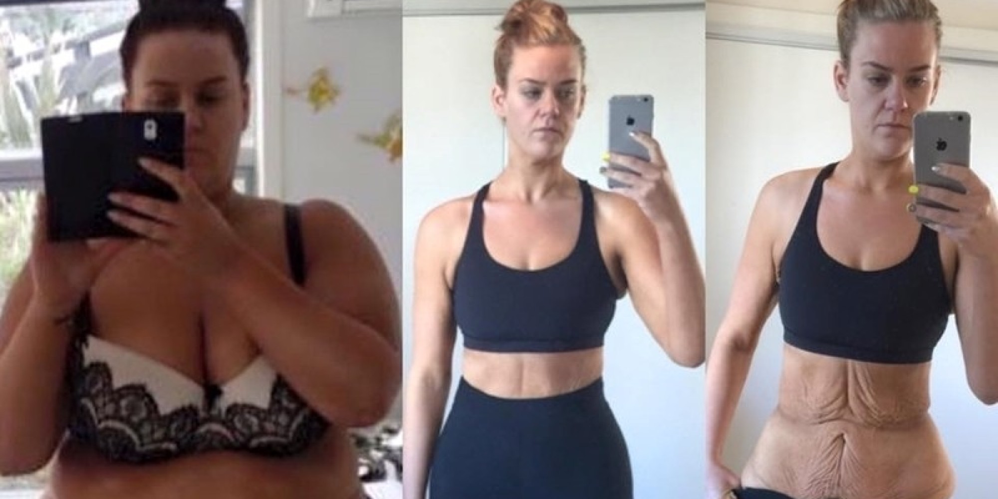 Simone Anderson, Accused Of 'Faking' Weight Loss, Shuts Up ...