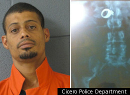 Man Swallows Ring