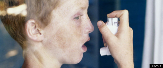 Asthma
