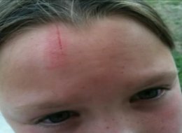 Monkey Attacks Eight-Year-Old Girl Outside Walmart 
