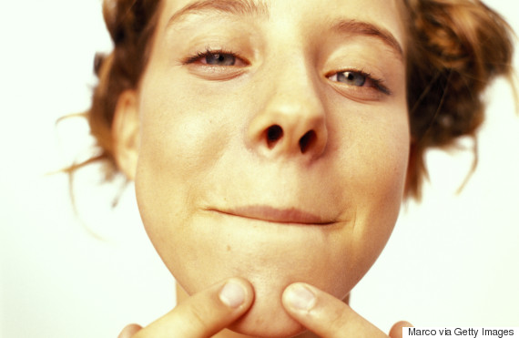spotty chin