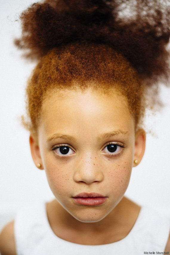 Enlever la pigmentation sur la personne chez le cosmétologue