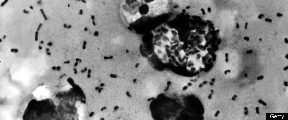 Medieval Plague Extinct