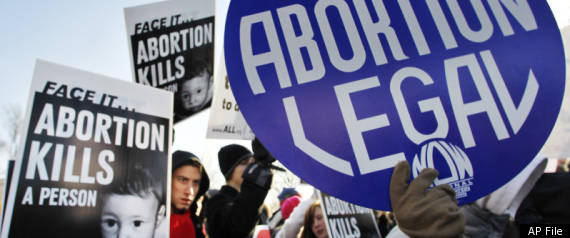 Abortion