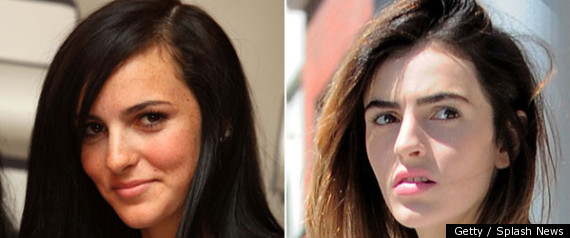 Ali Lohan Face Changes