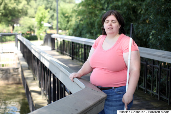Woman Blinds Herself As Body Identity Integrity Disorder Makes Her Believe Shes Meant To Be