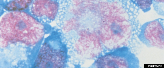 Gamers Aids Retroviral Protease