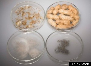 Restaurants Food Allergies