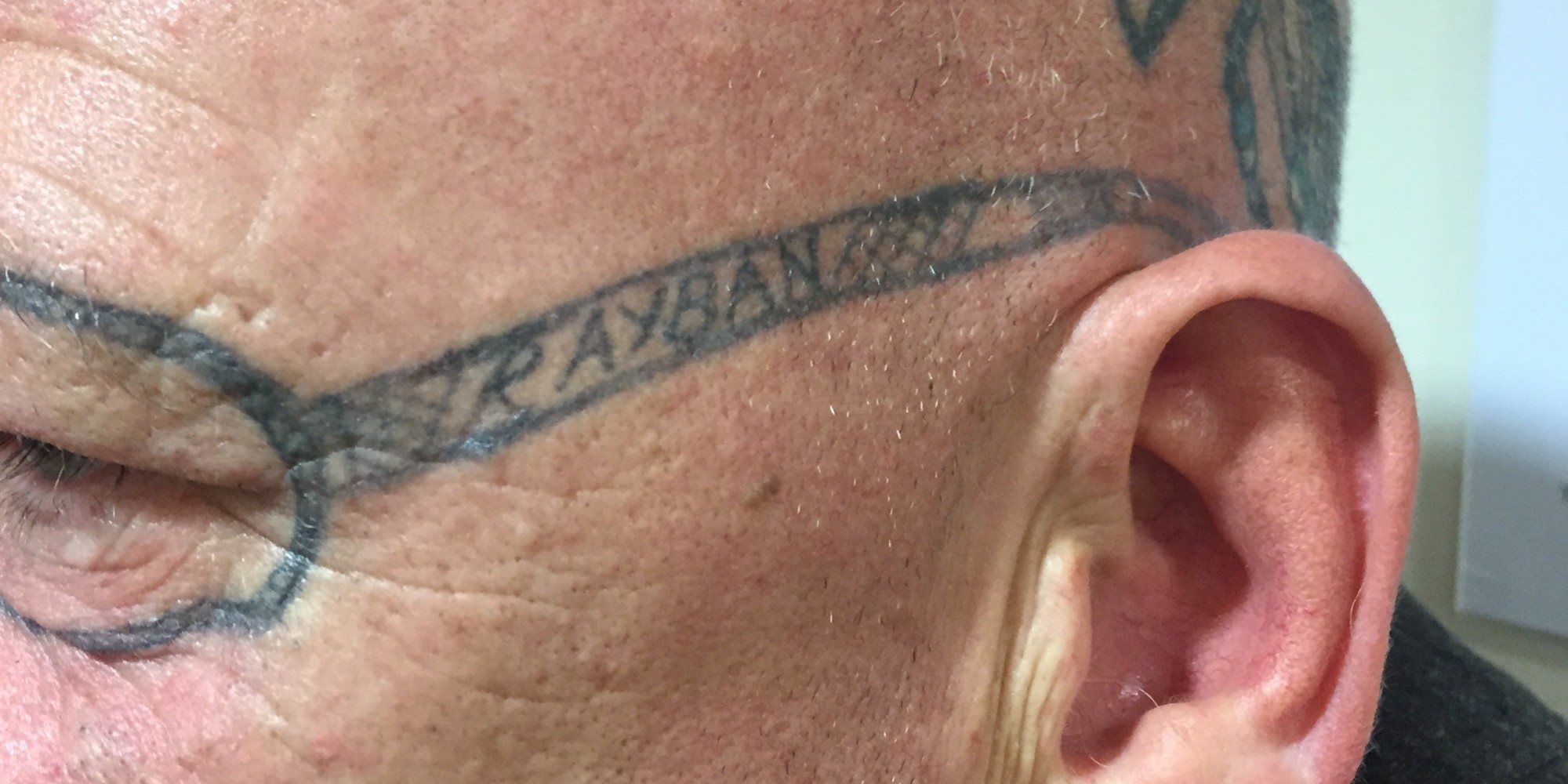 Man Wakes Up With Ray Ban Sunglasses Tattooed On His Face After 