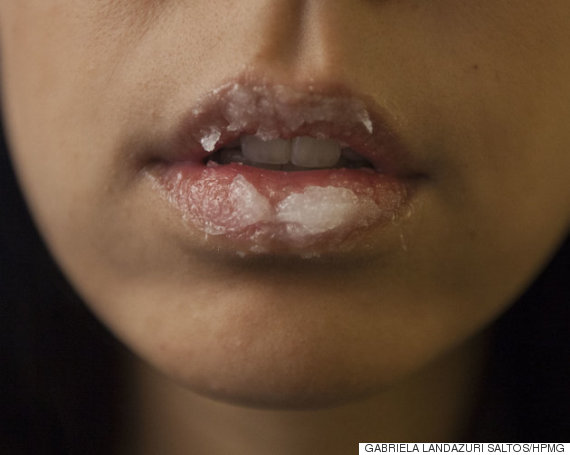 lipscrub