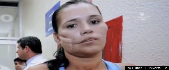 Karla Flores Grenade Face