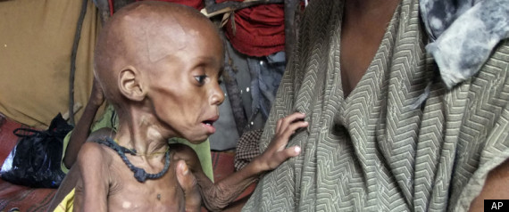 Somalia Famine