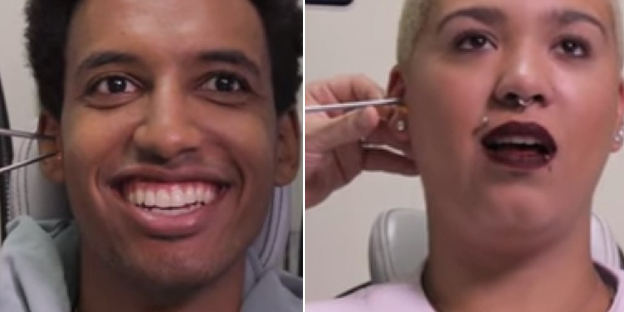 Video Shows People Getting Their Ear Wax Syringed, The Results Are