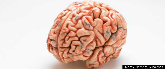 Alzheimers Infection
