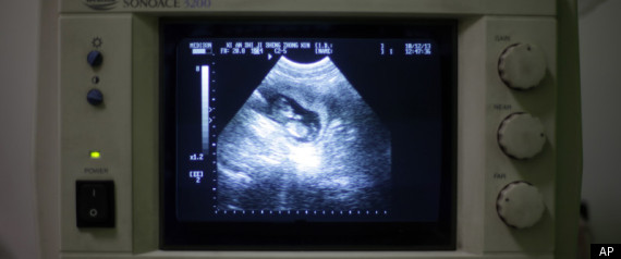 Bachmann Pushes to Erode Roe v Wade