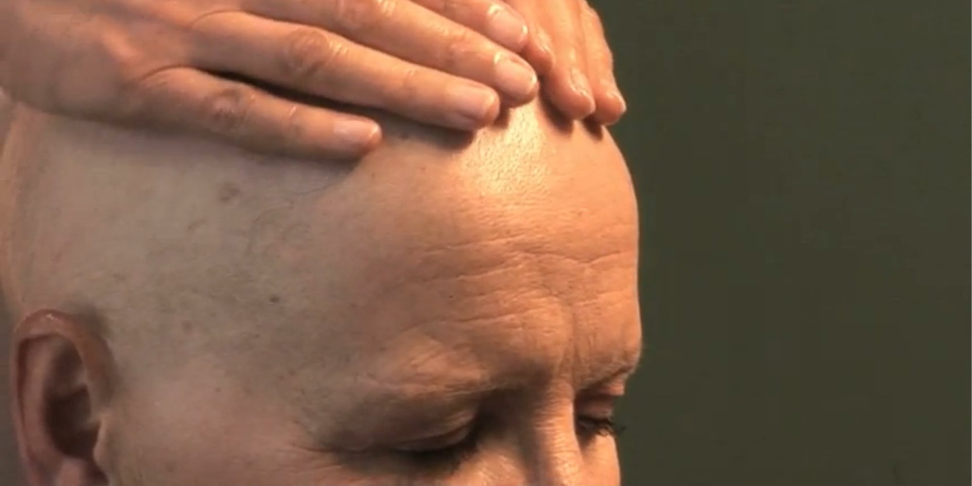 Chemotherapy Scalp Care Tutorial: How To Take Care Of The Skin On Your