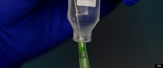 Nhs